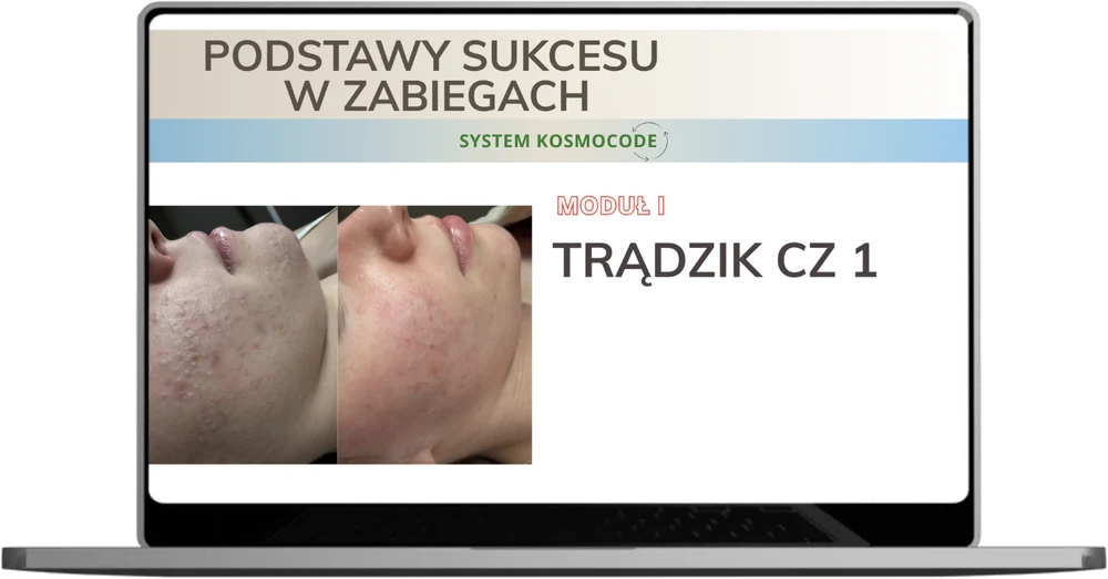 Lekcja: Trądzik, część 1