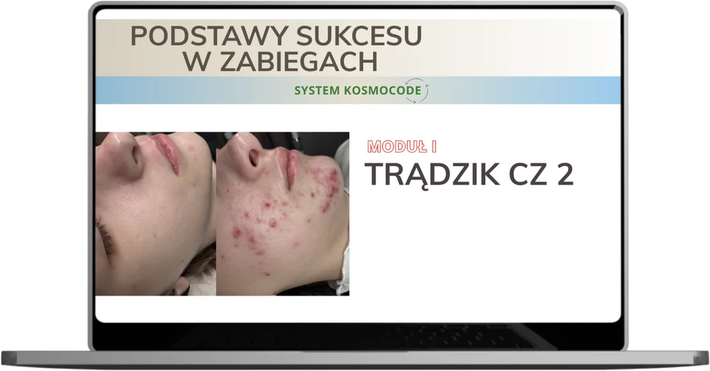 Lekcja: Trądzik, część 2